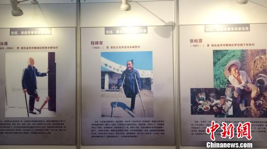 日軍在浙細菌戰(zhàn)受害幸存者的照片、悲慘遭遇口述 張煜歡 攝