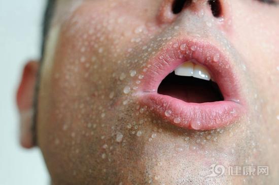 很容易出汗？暗示身體“故障”了！