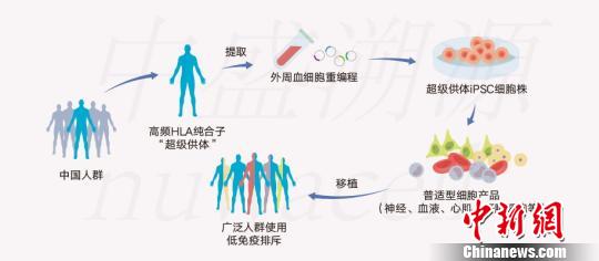 俞君英團(tuán)隊(duì)通過技術(shù)攻關(guān)配型iPSC細(xì)胞系原理圖?！≈惺⑺菰垂﹫D 攝