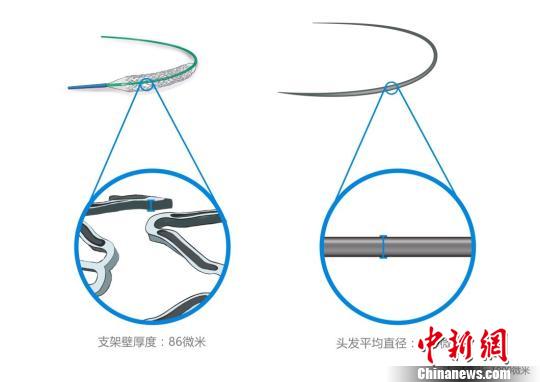 火鷹支架壁的凹槽與頭發(fā)直徑對(duì)比圖?！」﹫D 攝